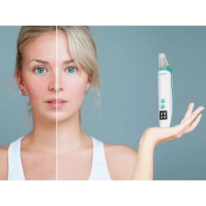 Beper - Genopladelig porerenser USB/5V 400 mAh